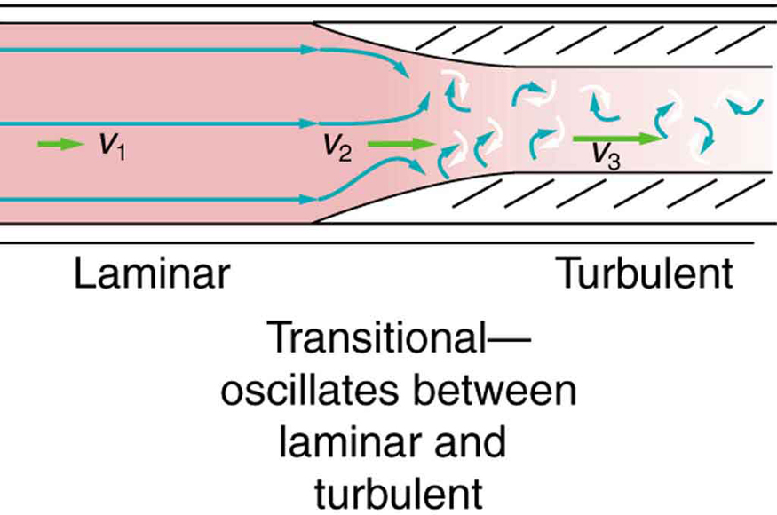 Figure shows a rectangular section of a blood vessel. The blood flow is shown toward right. The blood vessel is shown to be broader at one end and narrow toward the opposite end. The flow is shown to be laminar as shown by horizontal parallel lines. The velocity is v one in the broader section of blood vessel. The junction where the tube narrows the velocity is v two. The lines of flow are shown to bend. The regions where the blood vessels are narrow, the flow is shown to be turbulent as shown to by curling arrows. The velocity is given by v three toward right. The length of the arrows depicting the velocities represent that v three is greater than v two greater than v one.