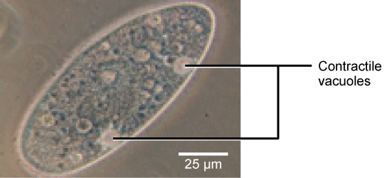 A transmission electron micrograph shows an oval-shaped cell. Contractile vacuoles are prominent structures embedded in the cell membrane that pump out water.