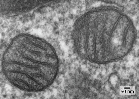 This micrograph shows two round, membrane-bound organelles inside a cell. The organelles are about 400 microns across and have membranes running through the middle of them.