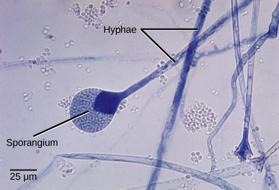  Micrograph shows several long, thread-like hyphae stained blue. One hypha has a round sporangium, about 35 microns in diameter, at the tip. The sporangium is dark blue at the neck, and grainy white–blue elsewhere. Spores that have already been released appear as small white ovals.