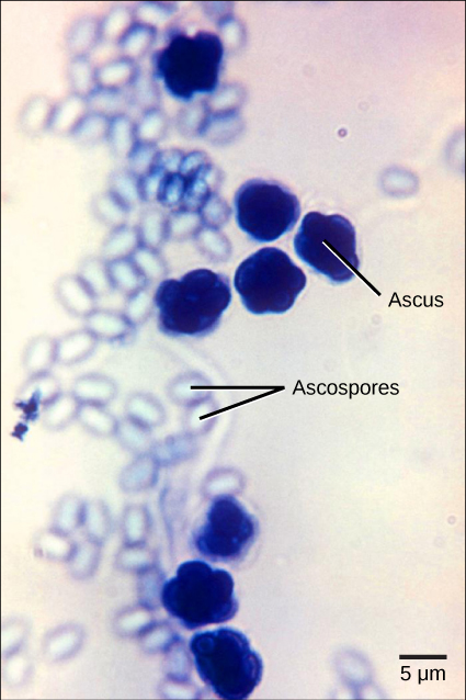 Micrograph shows asci, which appear as multiple, sphere-like shapes fused together into a structure about 7 microns across, and ascospores, which are small, light blue ovals about two microns wide by three microns long released from the asci.