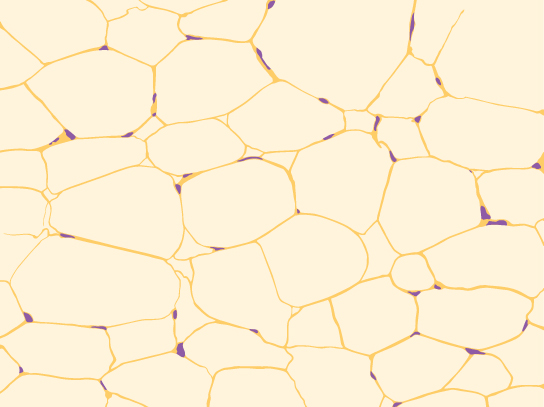 Illustration shows irregularly shaped cells with tiny nuclei clustered next to the cell’s outer membrane.