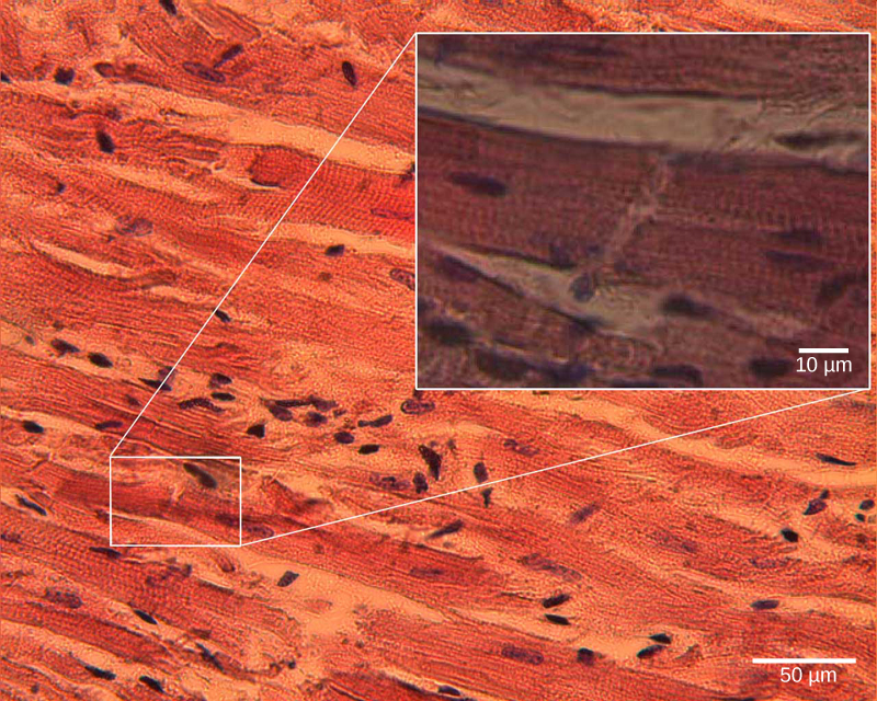 Micrograph shows cardiac muscle cells, which are oblong and have prominent striations.