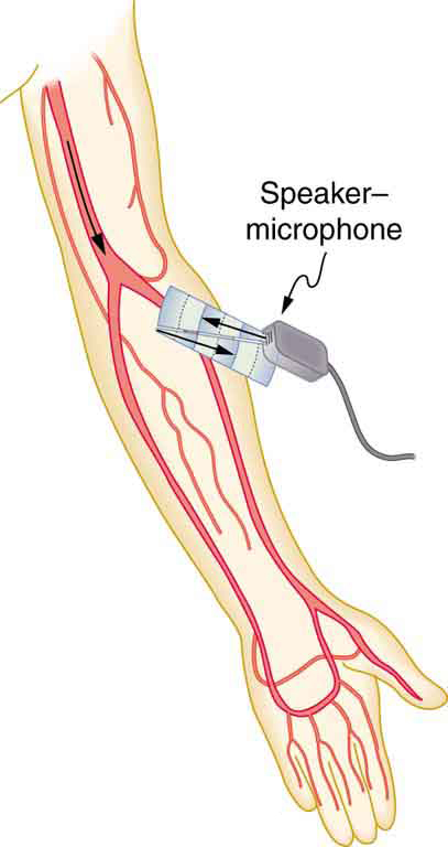 The picture represents an ultrasound device scanning the arteries and veins of a human hand.