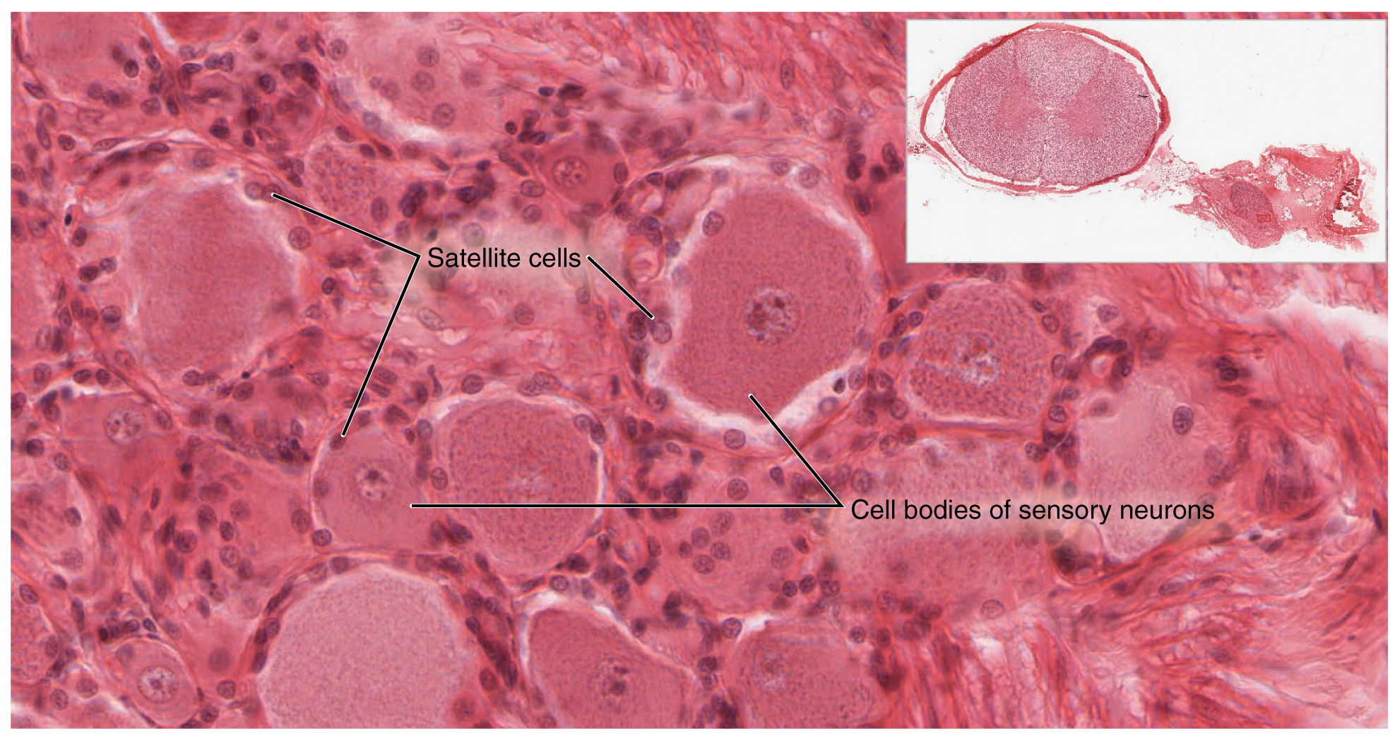 This micrograph shows a magnified view of the dorsal root ganglion, showing the satellite cells and the cell bodies of sensory neurons.