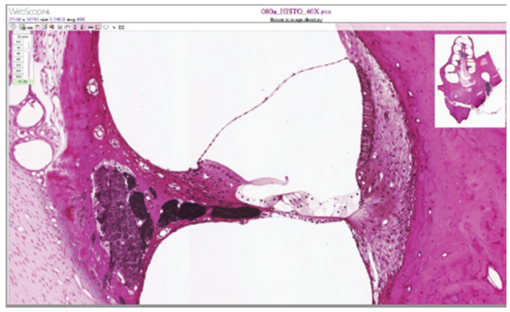 This micrograph shows the ultrastructure of the cochlea.