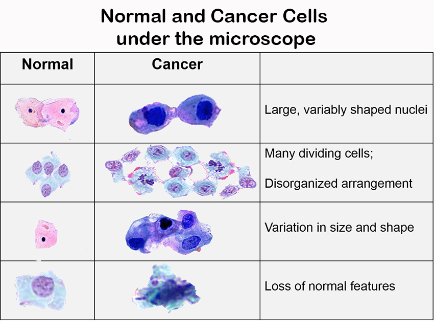 Comparison of normal and cancerous cells