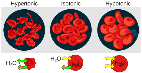 The left part of this illustration shows shriveled red blood cells bathed in a hypertonic solution. The middle part shows healthy red blood cells bathed in an isotonic solution, and the right part shows bloated red blood cells bathed in a hypotonic solution.