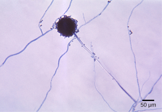  Micrograph shows Aspergillus mycelia, which look like long threads, and a spherical conidiophore about 40 microns across.