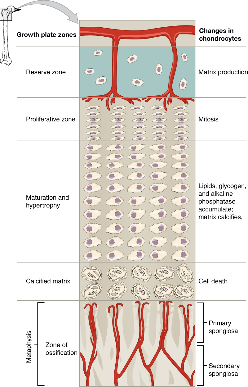 This illustration shows the zones bordering the epiphyseal plate of the epiphysis. The topmost layer of the epiphysis is the reserve zone, which is colored blue because it is made of cartilage. Two arteries are shown travelling through this zone to supply nutrients to the second zone: the proliferative zone. Here, five chondrocytes are undergoing mitosis. They continually divide, producing five long rows of chondrocytes. The next zone is the zone of maturation and hypertrophy. Here, lipids, glycogen and alkaline phosphatase accumulate, causing the cartilaginous matrix to calcify. This zone consists of five rows of ten chondrocytes which are increasing in size as one moves down a row. The next zone is the calcified matrix. Here, the chondrocytes have hardened and die as the matrix around them has calcified. The bottommost row is the zone of ossification. This zone is actually part of the metaphysis. Arteries from the metaphysis branch through the newly-formed trabeculae in this zone. The newly deposited bone tissue at the top of the zone of ossification is called the primary spongiosa. The older bone at the bottom of the zone of ossification is labeled the secondary spongiosa.