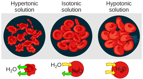 The left part of this illustration shows shriveled red blood cells bathed in a hypertonic solution. The middle part shows healthy red blood cells bathed in an isotonic solution, and the right part shows bloated red blood cells bathed in a hypotonic solution.