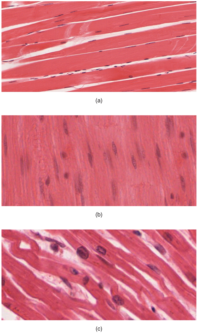 This shows three micrographs, each depicting one of the three muscle tissues. Picture A shows skeletal muscle tissue, which is dense strips of pink tissue that somewhat resemble bacon in appearance. Many small nuclei are dispersed throughout the tissues. The nuclei are flat and elongated, with multiple nuclei clustered into each cell. Picture B shows smooth muscle, which is densely packed and looks similar to skeletal muscle except that each cell only has one oval-shaped nucleus. Picture C shows cardiac muscle. Unlike skeletal and smooth muscle cells, cardiac muscle cells are not densely packed. The cardiac cells are branched, creating a large amount of space between each muscle cell. 