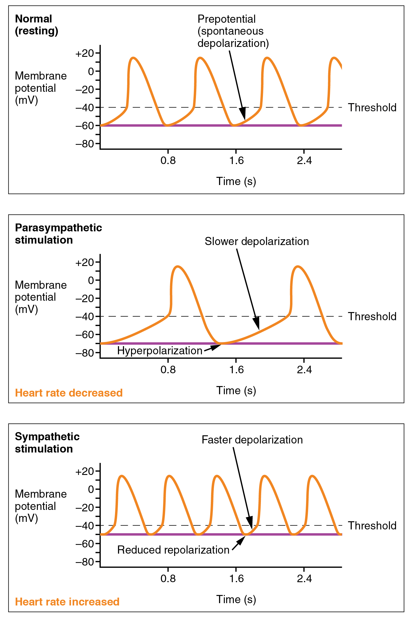 This figure shows three graphs. The top panel shows the normal or resting potential with time. The middle panel shows membrane potential with time in a parasympathetic stimulation where the heart rate is decreased. The bottom panel shows membrane potential with time in a sympathetic stimulation with increased heart rate.