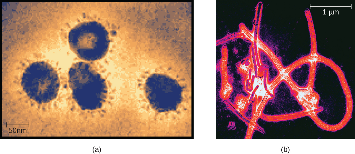 Figure A is a TEM micrograph showing large circles with many small projections protruding outwards from the edge of the circles. A scale bar shows how large 50 nanometers is relative to this micrograph. Figure B is a TEM micrograph showing long red strands forming a knot-like structure.