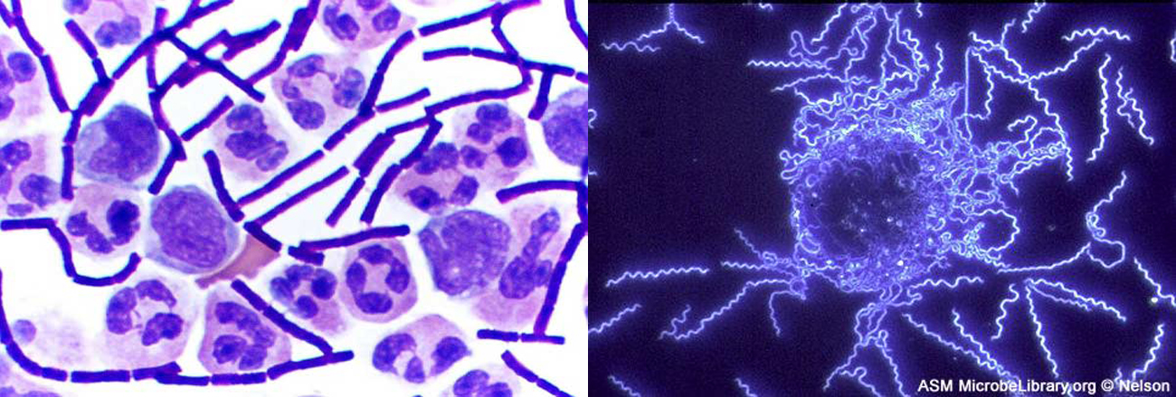 The left image shows a clear background with chains of solid purple rods and larger circular cells. The larger cells contain darker purple blotches inside each cell. The right image shows a black background with thin, glowing spirals.