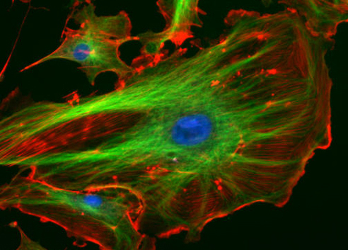 An image shows a large cell in the foreground and other cells further in the background. Each cell has an irregular shape with a large blue circle in the center. Green lines surround the blue circle and span out towards the edges of the cell. The rest of the cell is red with a bright red edge. The background of the image is black.