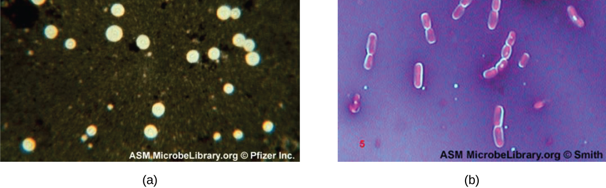 Micrograph a shows clear circles on a black background. Micrograph b shows red rods with a clear halo on a dark background.