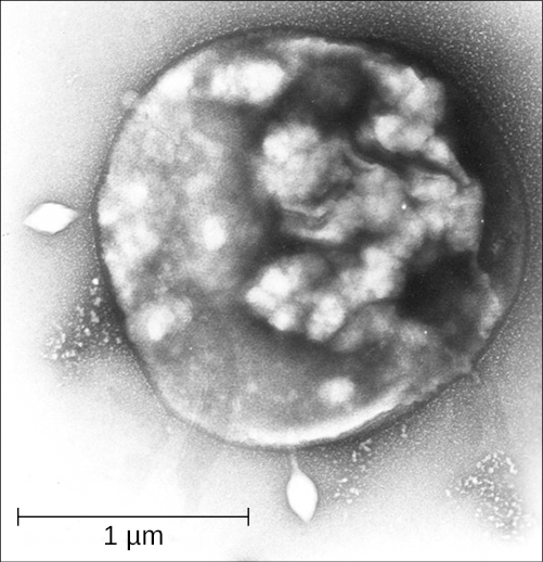 A mircrograph of a spherical cell with diamond-shpaed structures inside it.