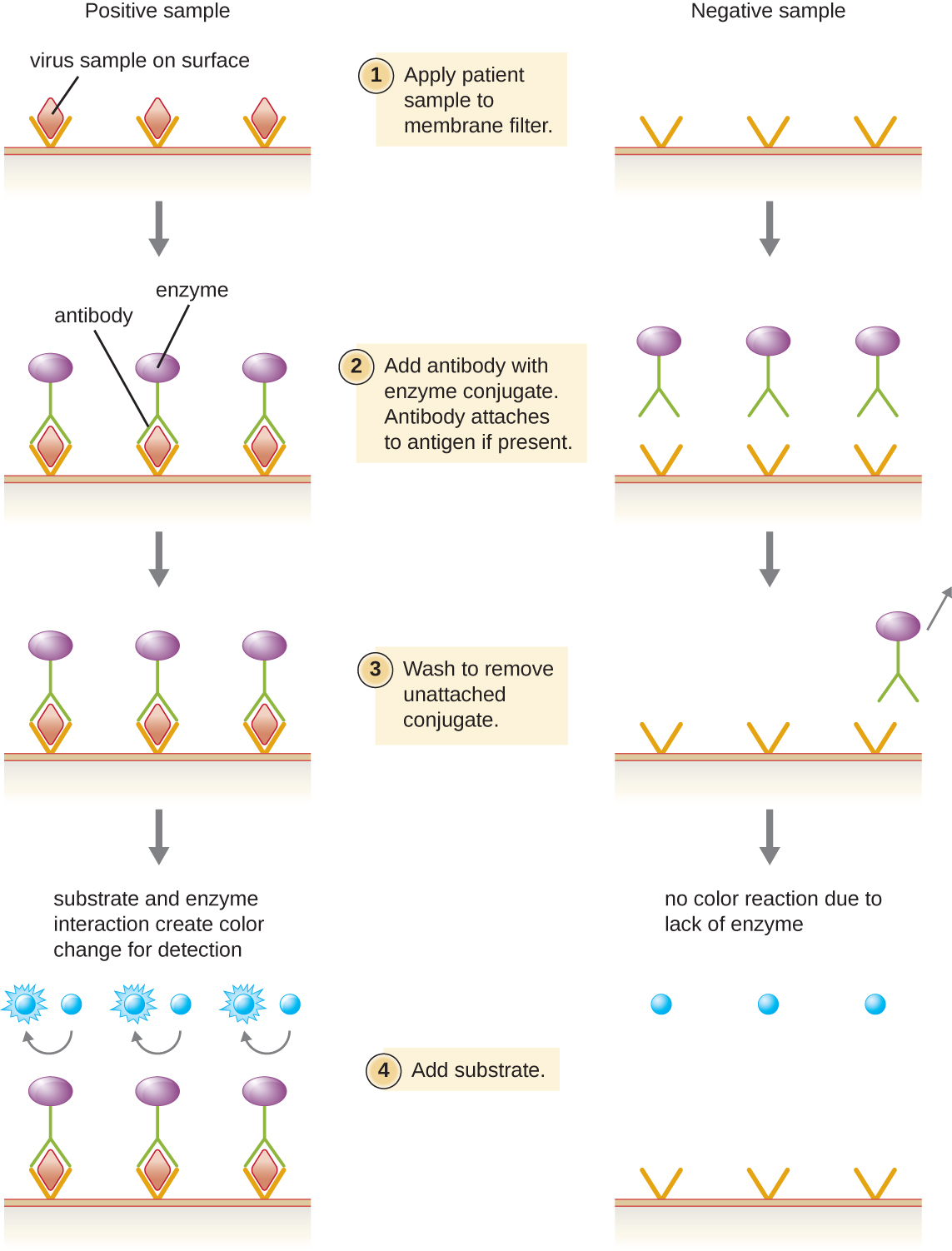 The explanation of EIA is separated to show what occurs in a positive sample and what occurs in a negative sample. First patient sample is applied to a membrane filter. If the sample contains viruses they are trapped by the filter. Next, antibody with enzyme conjugate is added. Antibody will attach to antigen if present. Next is a wash step. If the virus is present the enzyme binds to the virus, otherwise the enzyme washes away. Finally substrate is added. If the antibody is present (because it is bound to the virus) the attached enzyme causes a color change. If no enzyme linked antibody is present, no color change occurs.
