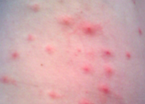 Skin with red raised bumps.