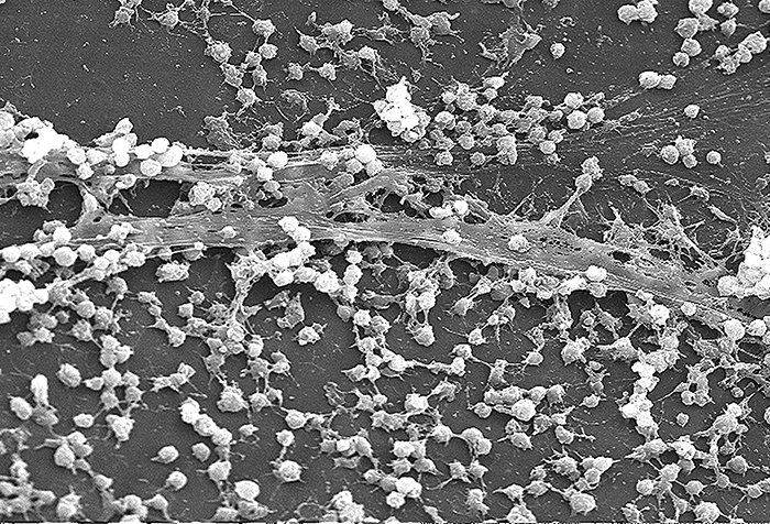 Micrograph of round cells attached to a surface by long strands.