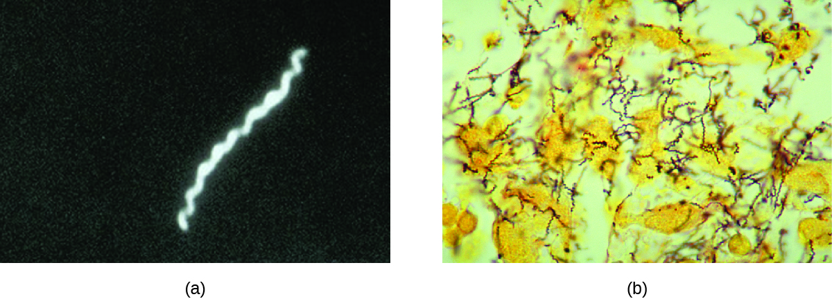 a) micrograph of a spiral cell. b) micrograph of many spiral cells.