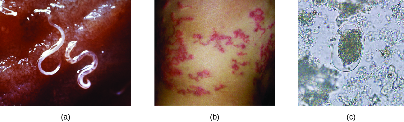 a) photo of a cler worm attached to tissue. B) photo of red lines in the skin. c) Micrograph of an oval structure.