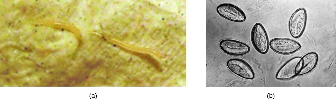 a) photo of a small clear worm. B) micrograph of cells shaped like pointed ovals.