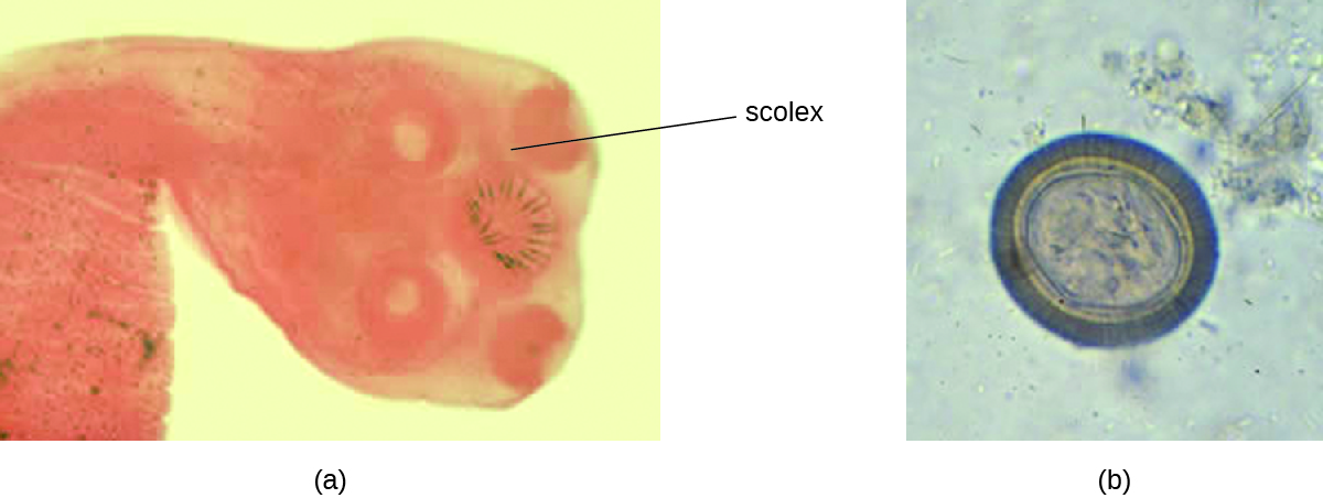 a) a micrograph of a worm with a round end labeled scolex. The scolex has round structures that look like suckers. B) micrograph of an oval cell with a thick wall.