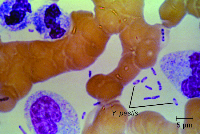 A micrograph showing small rod shaped purple cells in between larger human cells. The purple bacterial cells have a small clear circle in the center.