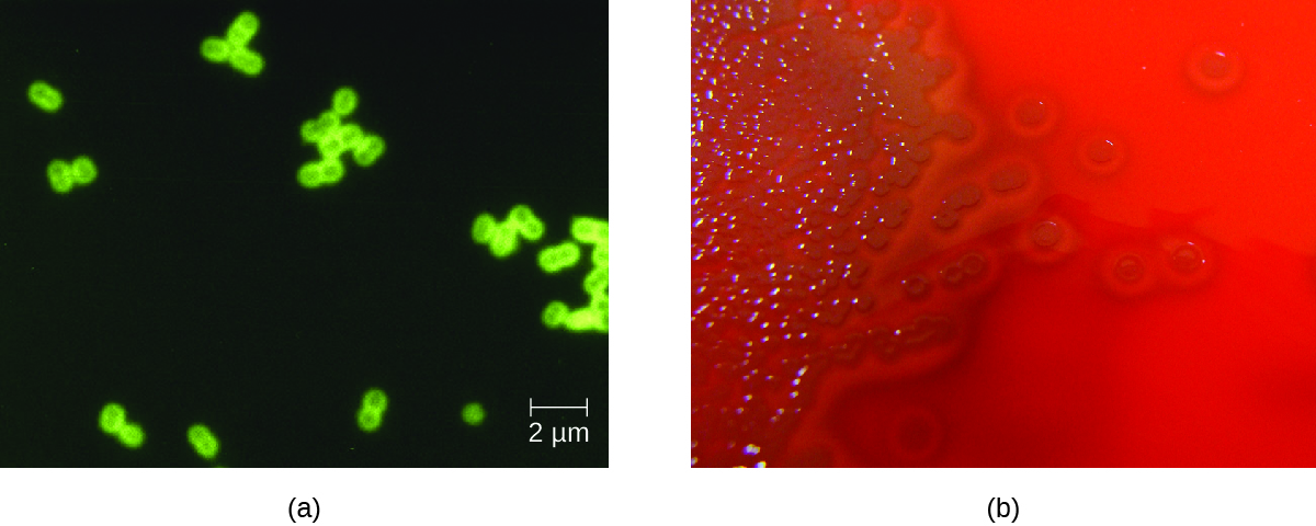 a)Micrograph of green closing circles in pairs on a dark background. Photograph of a red plate with  brown colonies. Clearing is seen around the colonies.